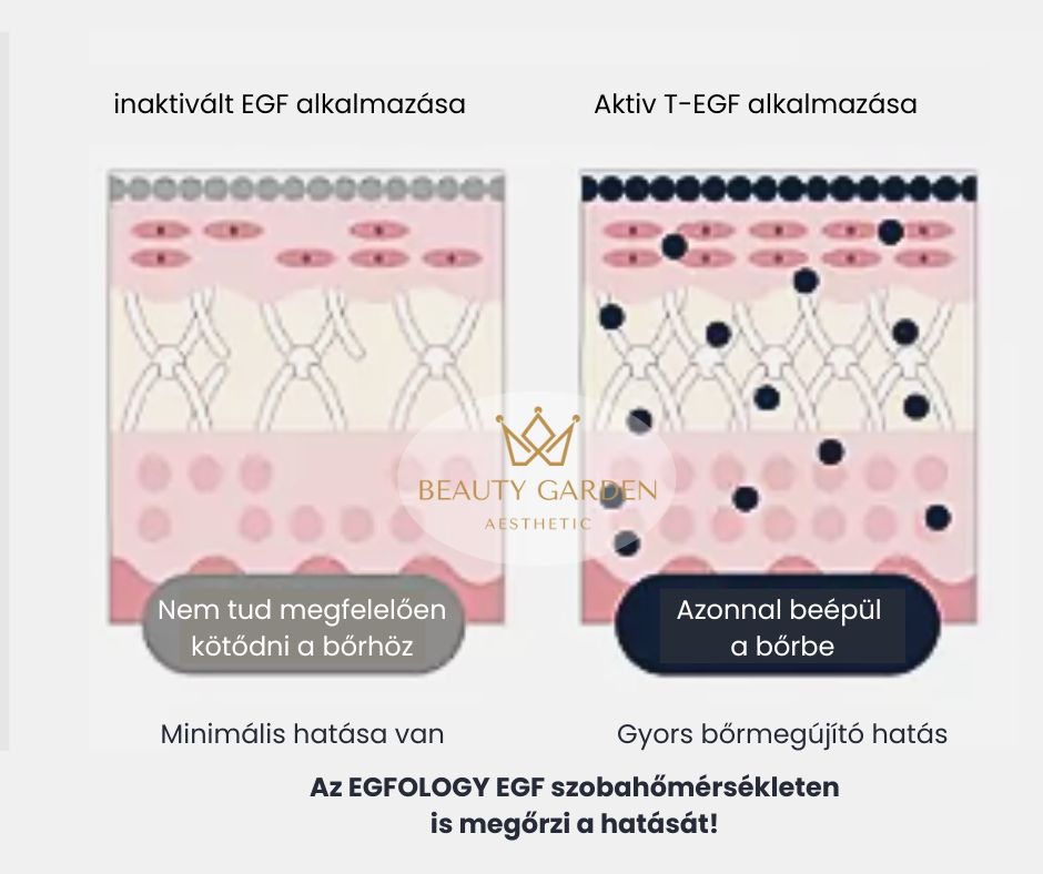 egfology egf velemeny exoszóma